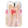 Root Canals