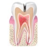 Root Canals